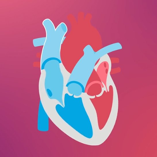 Watch a video on mitral regurgitation